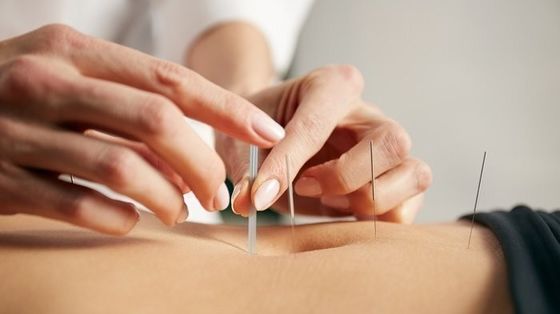 Các kim châm nội da thẩm mỹ và y tế Cấu trúc thẳng đảm bảo an toàn và hiệu quả trong châm cứu