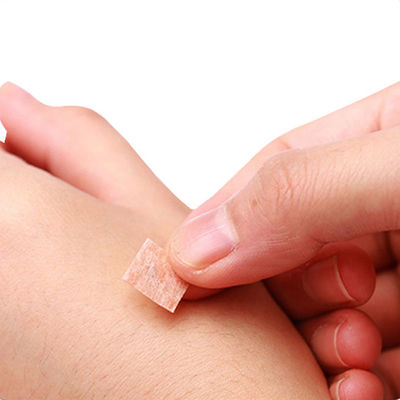 Châm châm sắc nét kim châm CE TUV ISO GMP cho y học truyền thống Trung Quốc