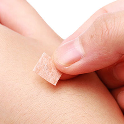 Kim châm gói Số lượng 100 miếng mỗi hộp Bấm và giải phóng Phương pháp chèn kim châm Bấm kim châm